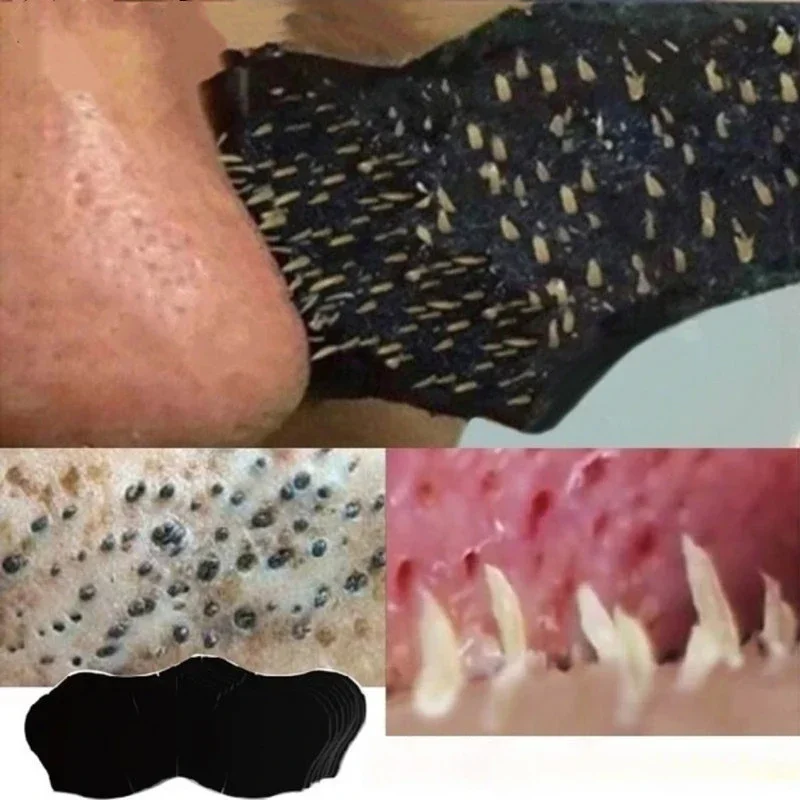 Unisex Blackhead Remove Mask N - Charcoal Pore Strip ulasan dan harga
