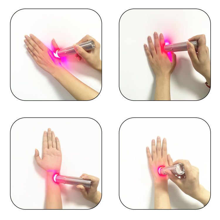Home Facial Device Skincare Wa - Skincare You ulasan dan harga