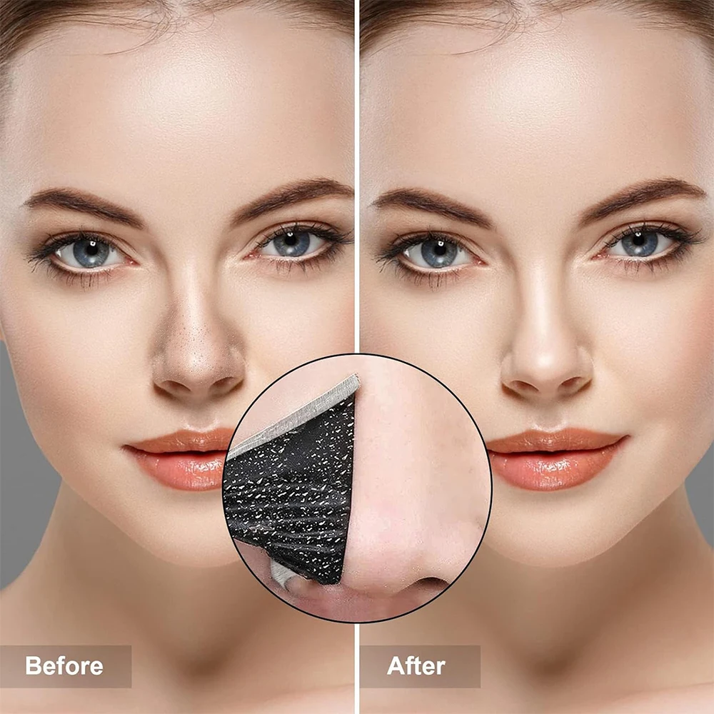 10PCS Unisex Blackhead Remove  - Charcoal Pore Strip ulasan dan harga