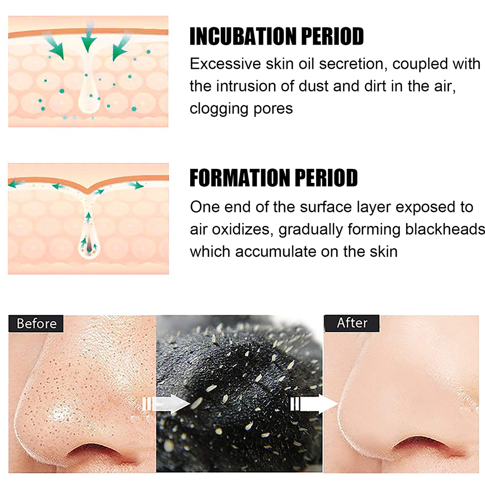 10PCS Unisex Blackhead Remove  - Charcoal Pore Strip ulasan dan harga